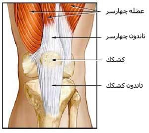 تاندونیت همسترینگ (تاندونیت عضله ی دو سر ران)