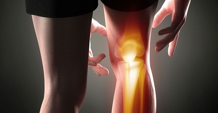تاندونیت پشت زانو