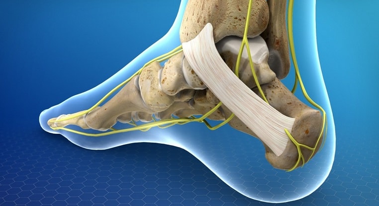 سندروم تونل تارسال-