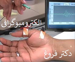 نوار عصب و عضله