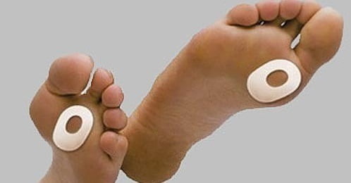 استفاده از پد مخصوص برای درمان میخچه پا